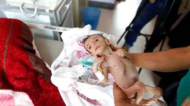 تقرير:الحرب جعلت 13 مليون طفل يمني في مرمى الموت
